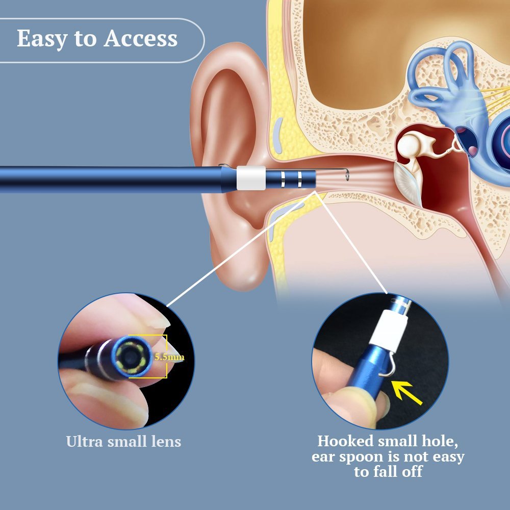 Premium Digital Phone Otoscope Camera 3 in 1