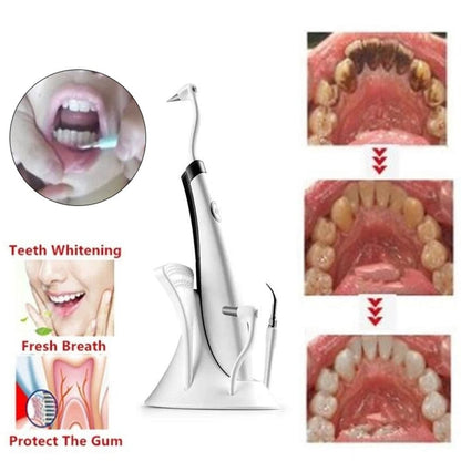 Dental Ultrasonic Plaque/Tartar Scaler & Calculus Stain Remover.