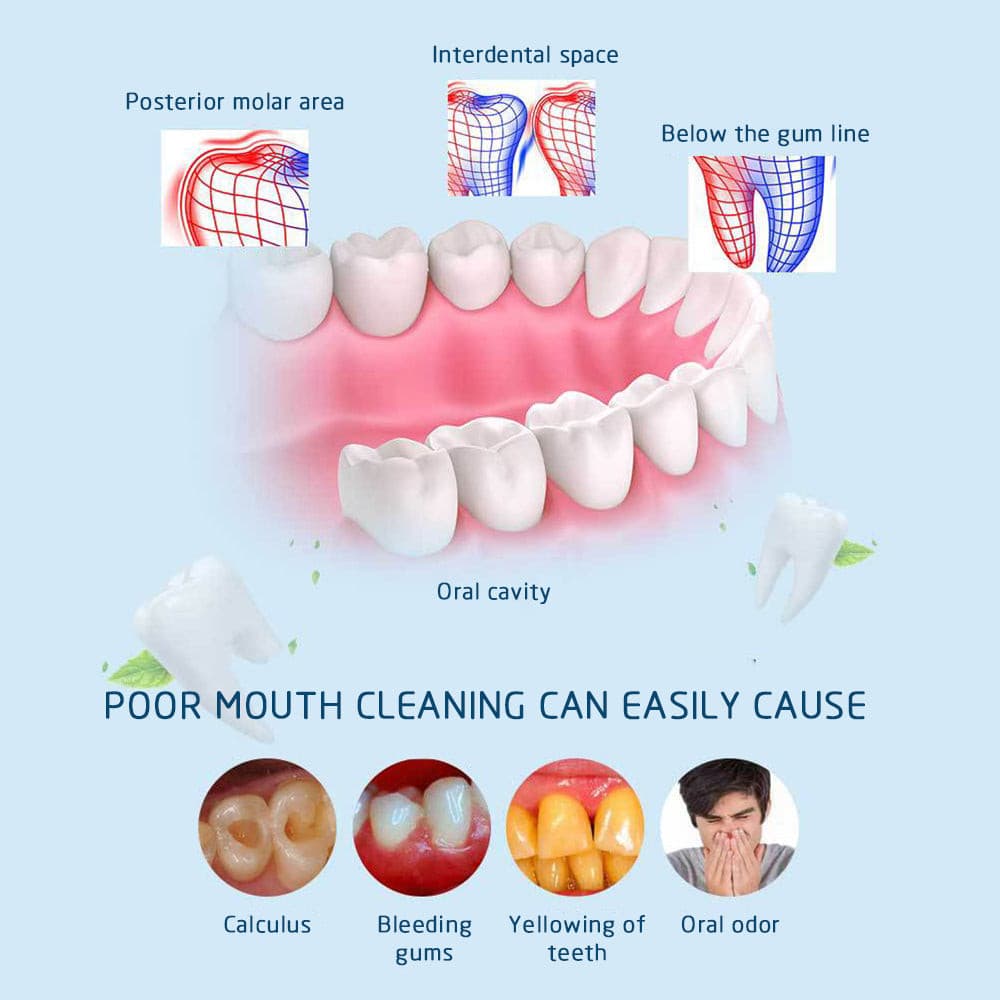 Dental Ultrasonic Plaque/Tartar Scaler & Calculus Stain Remover.