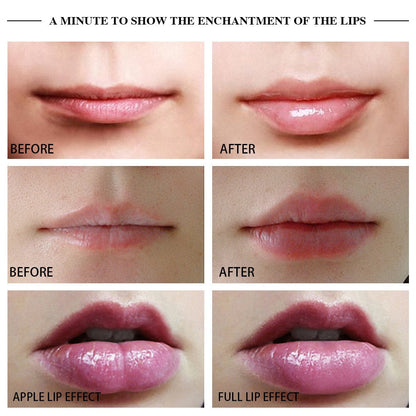 Premium Lip Plumper Handheld Device